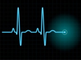 EKG serca