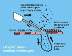 Peeling kawitacyjny twarzy