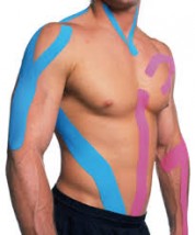 Kinezjotaping