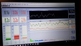 diagnoza QEEG i trening mózgu