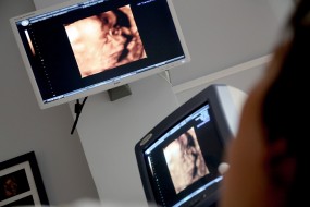 Monitoring audio/video