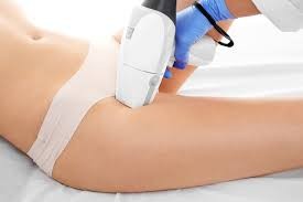 DEPILACJA LASEROWA IPL