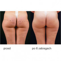 Eat Skin Shock - Fala uderzeniowa