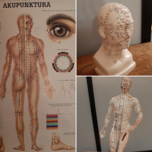 Akupunktura
